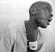 A Tutsi survivor of the Rwandan genocide of 1994